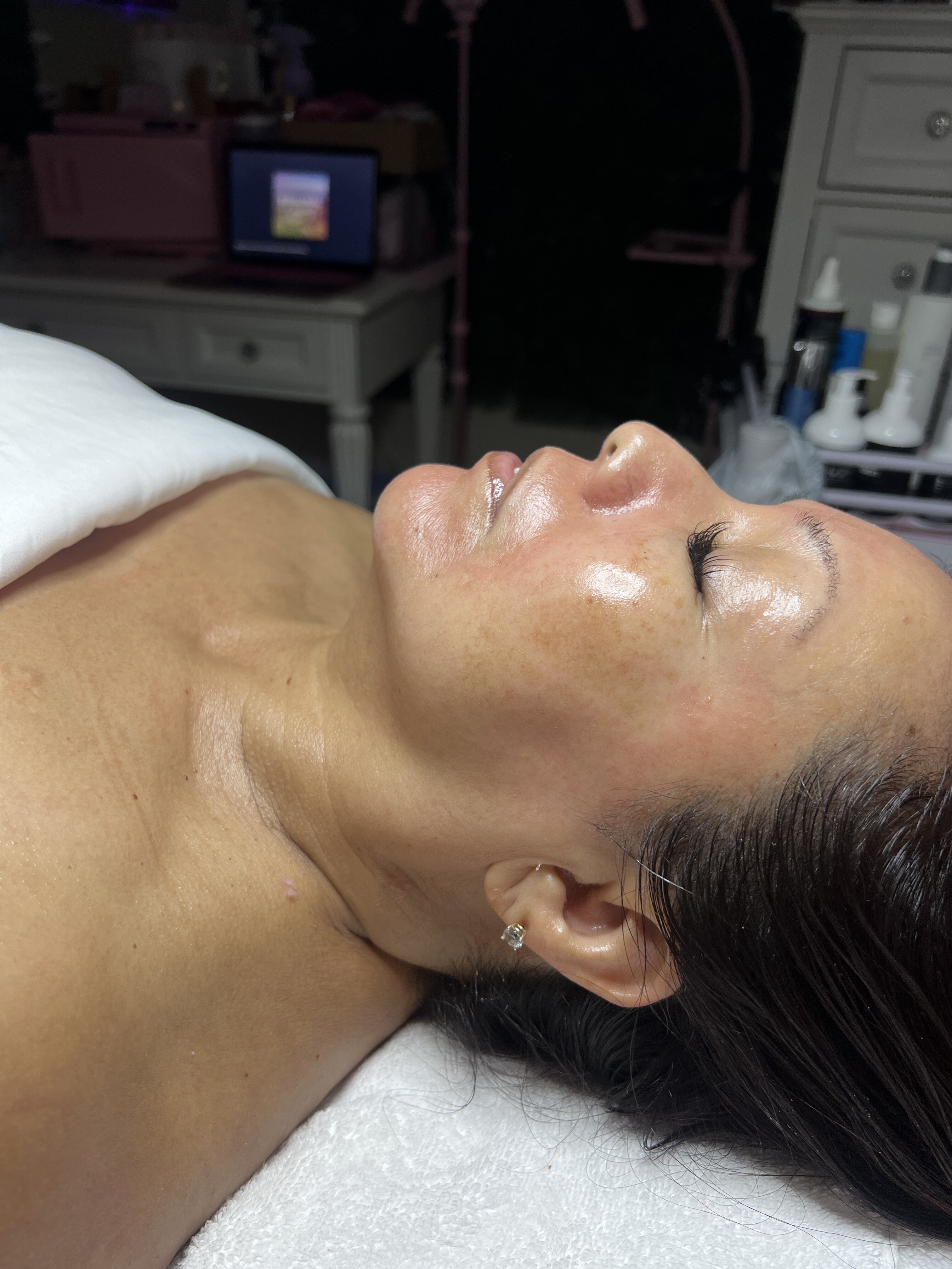 Client resting after a facial treatment